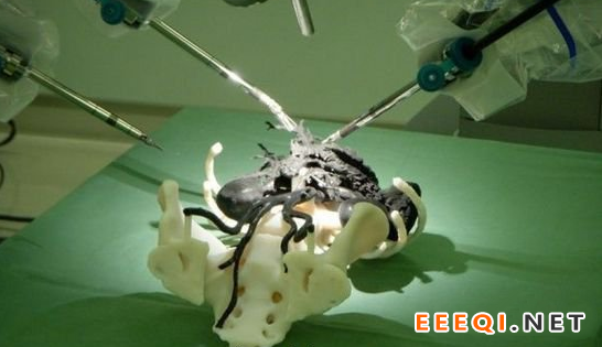 3D打印机在医疗行业使用价值